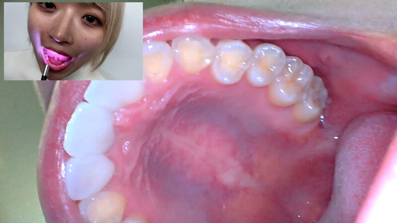 NKO-0500001 パート 17 - 30 分