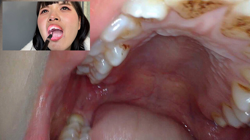 NKO-0500002 パート 12 - 30 分