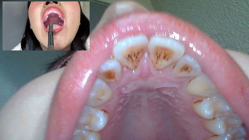 NKO-0500002 Bagian 13 - 30 minit