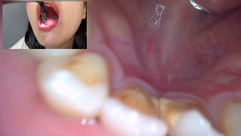 NKO-0500002 Bagian 14 - 30 minit