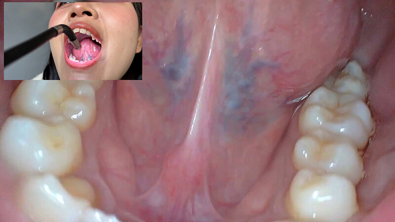 NKO-0500002 Bagian 15 - 30 minit