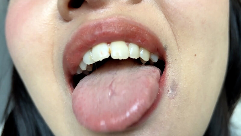 街角で声をかけて口内観察させてもらう コールセンターアルバイト あむちゃん 画像8