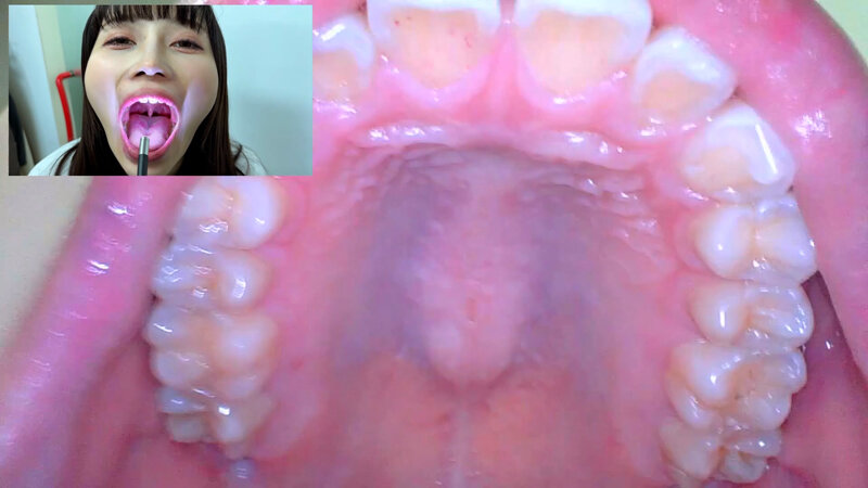 NKO-0500003 Part 10 - 30 minutes