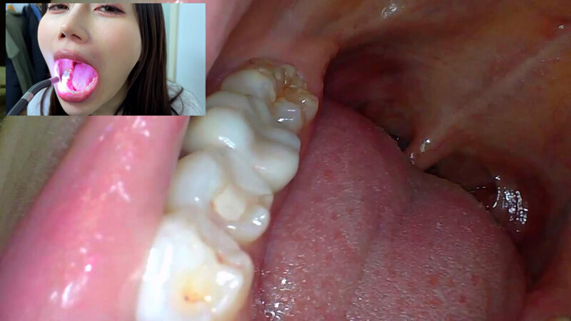 NKO-0500003 Part 11 - 30 minutes