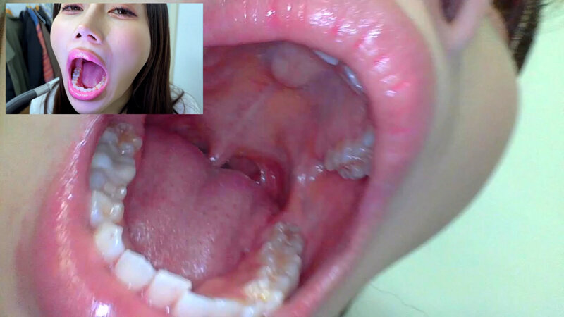 NKO-0500003 Part 12 - 30 minutes