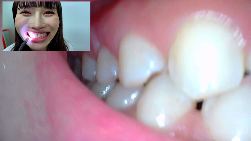 NKO-0500003 Part 14 - 30 minutes