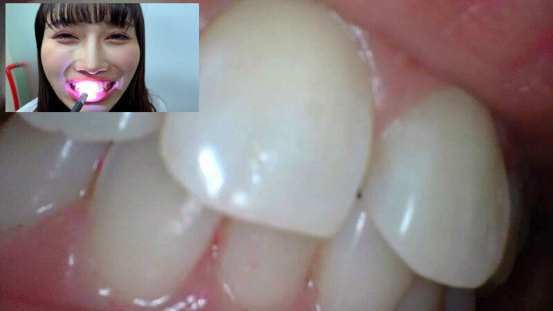 NKO-0500003 Part 15 - 30 minutes