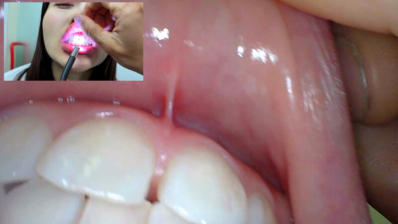 NKO-0500003 Part 16 - 30 minutes