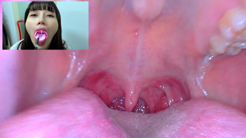 NKO-0500003 Part 8 - 30 minutes