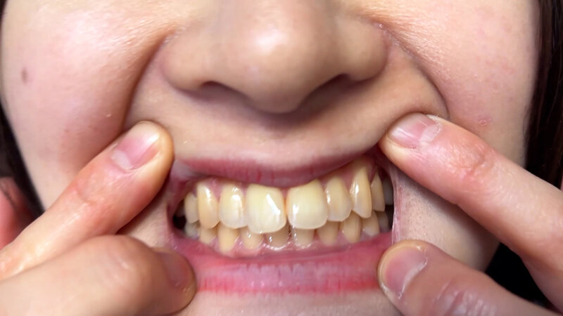 NKO-0500004 第 10 部分 - 30 分钟