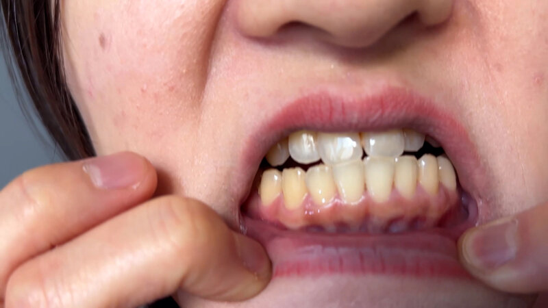 NKO-0500004 第 12 部分 - 30 分钟