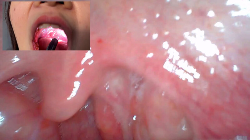 NKO-0500004 Part 13 - 30 minutes