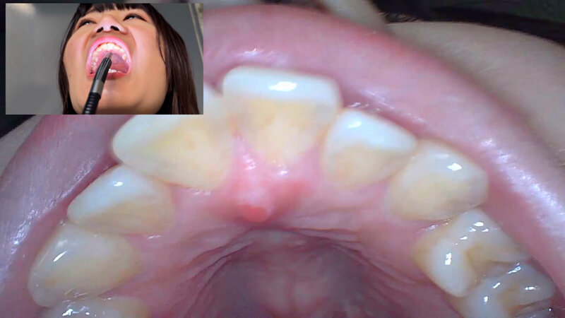 NKO-0500004 第 15 部分 - 30 分钟