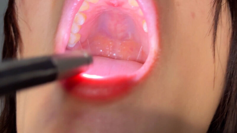 NKO-0500004 Part 17 - 30 minutes