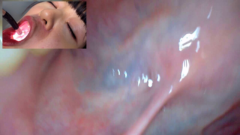 NKO-0500004 第 18 部分 - 30 分钟