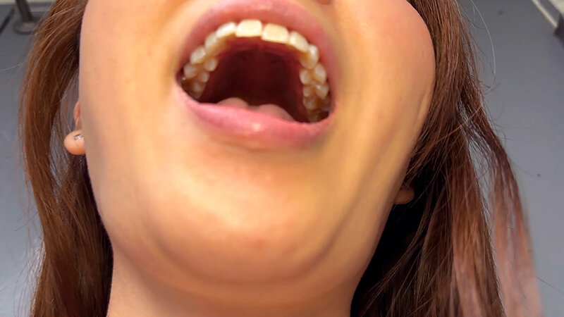 NKO-0600005 第 17 部分 - 30 分钟