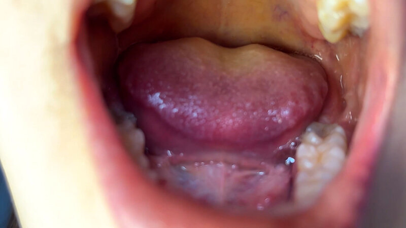 NKO-0600005 第 7 部分 - 30 分钟