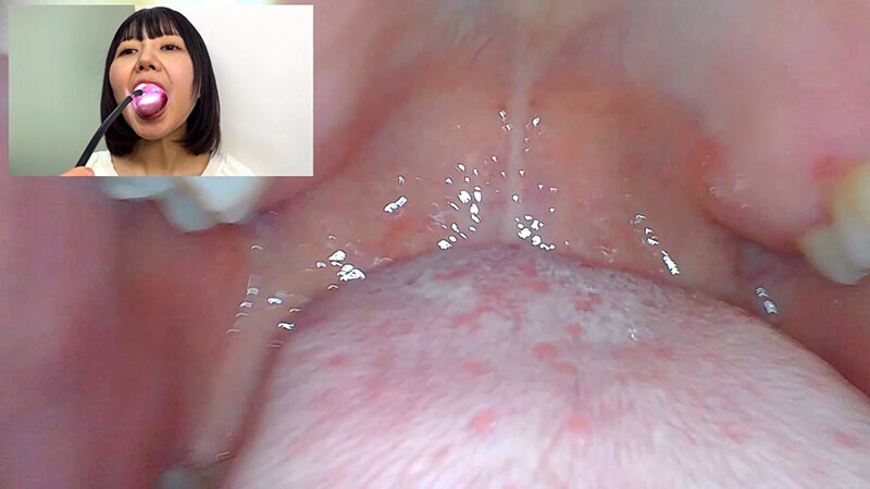 NKO-0600006 Part 11 - 30 minutes