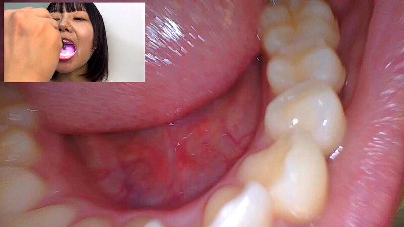 NKO-0600006 Part 14 - 30 minutes