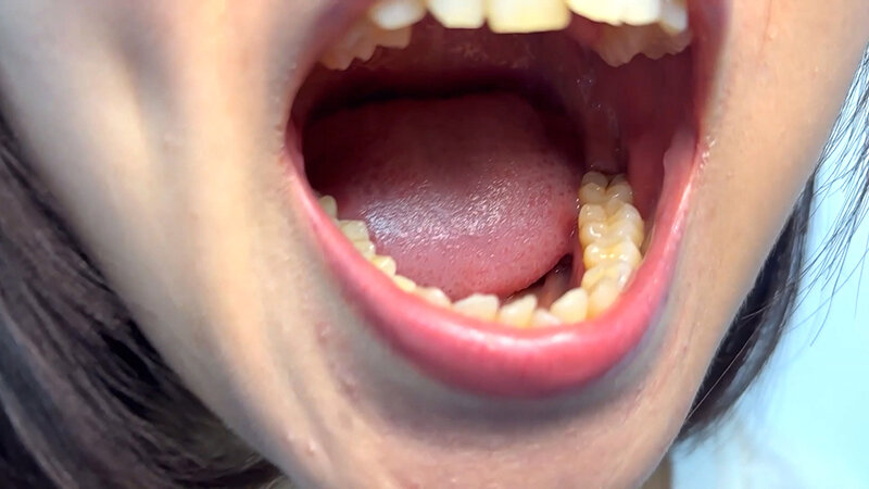 NKO-0600006 Part 5 - 30 minutes