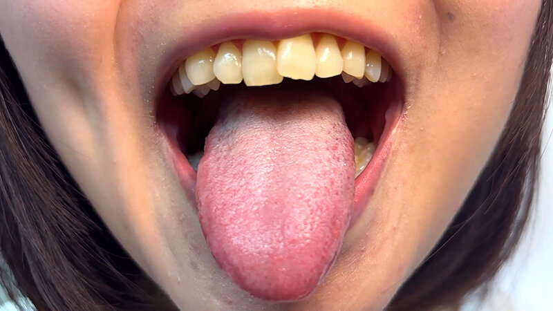 NKO-0600006 Part 7 - 30 minutes