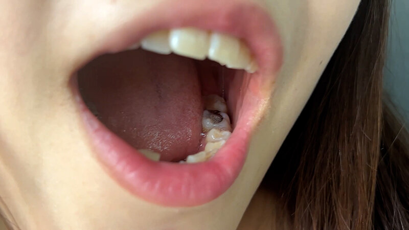 NKO-400003 Part 14 - 30 minutes