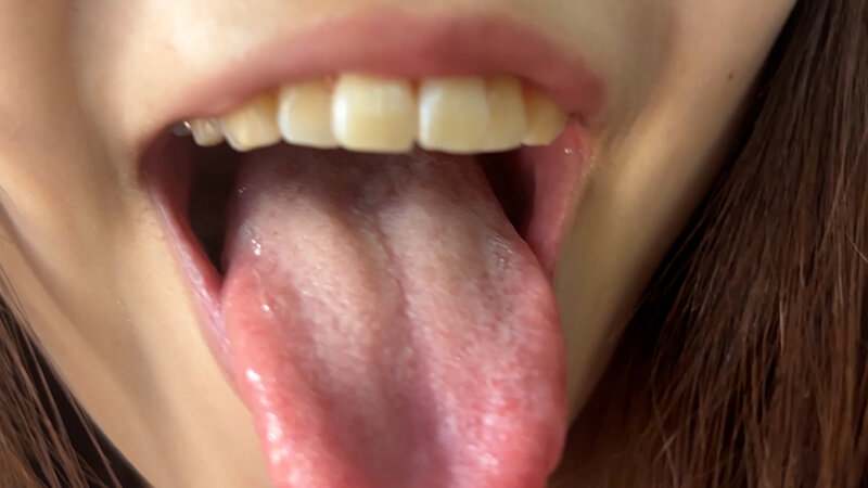 NKO-400003 Part 15 - 30 minutes