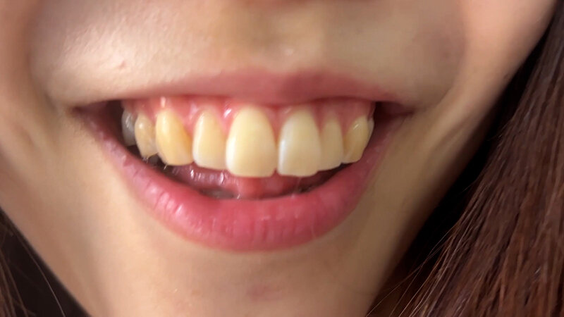 NKO-400003 Part 16 - 30 minutes