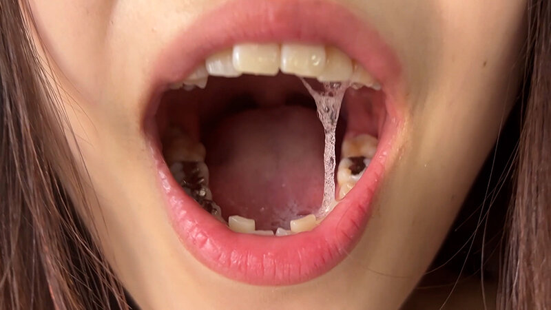 NKO-400003 Part 19 - 30 minutes