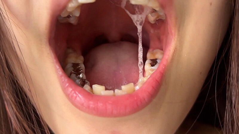 NKO-400003 Part 20 - 30 minutes