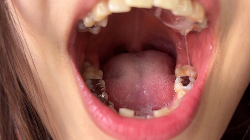 NKO-400003 Part 3 - 30 minutes