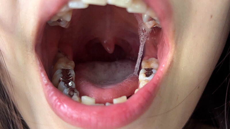 NKO-400003 Part 4 - 30 minutes