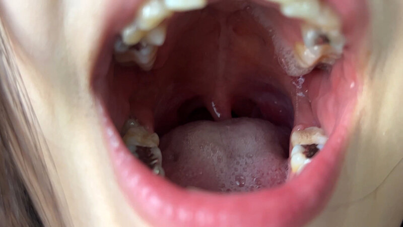 NKO-400003 Part 5 - 30 minutes