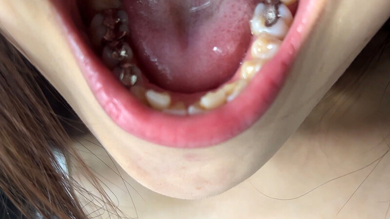 NKO-400003 Part 6 - 30 minutes