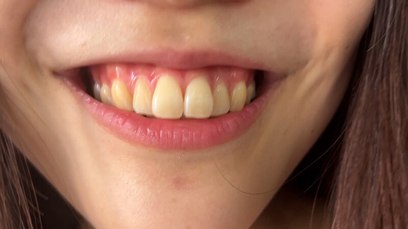 NKO-400003 Part 8 - 30 minutes