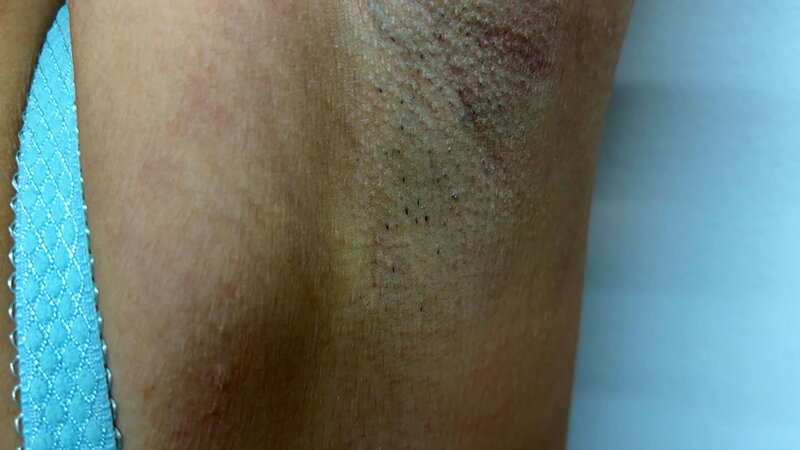 WAKN-0100001 第 14 部分 - 30 分钟