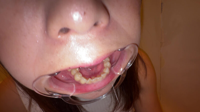 Y-276 Part 20 - 30 minutes