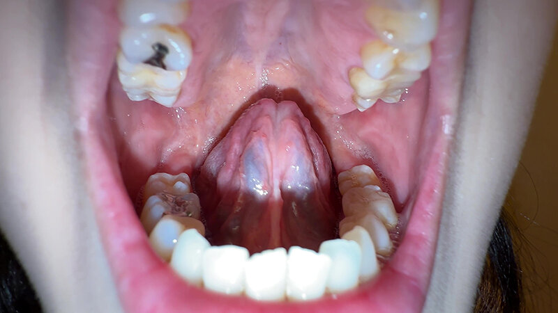 Y-287 Bagian 2 - 30 minit