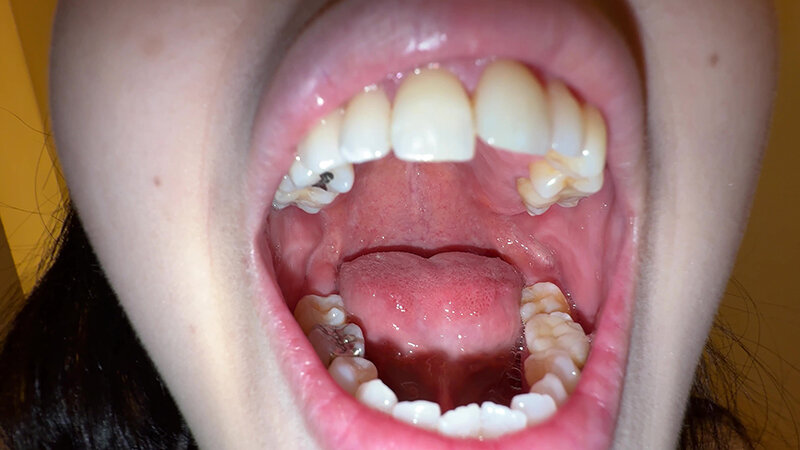 Y-289 Bagian 1 - 30 minit