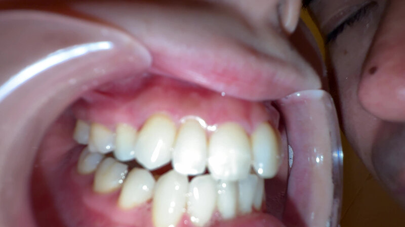 Y-289 Bagian 19 - 30 minit