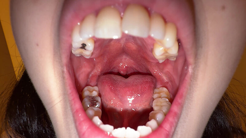 Y-289 Bagian 2 - 30 minit