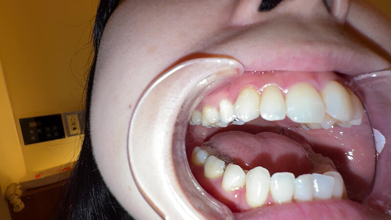 Y-289 第 20 部分 - 30 分钟