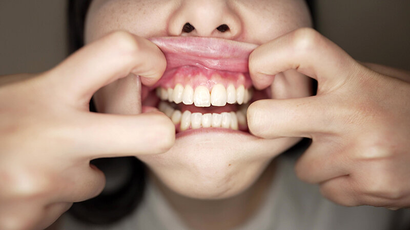 Y-290 Bagian 10 - 30 minit