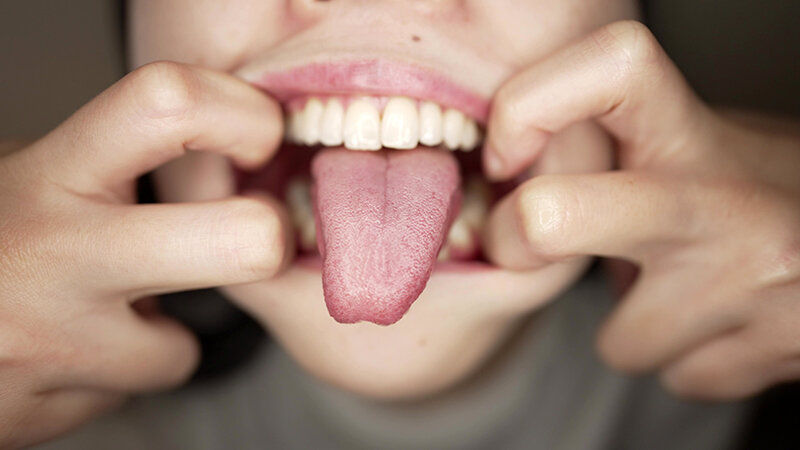 Y-290 Bagian 14 - 30 minit