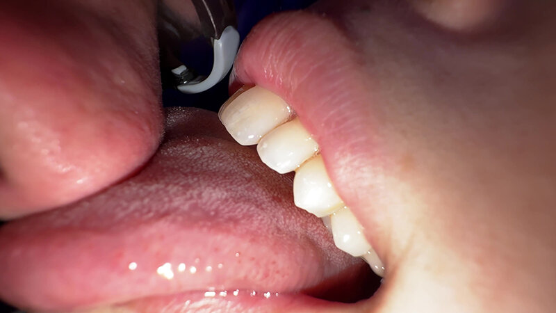 Y-291 Bagian 10 - 30 minit