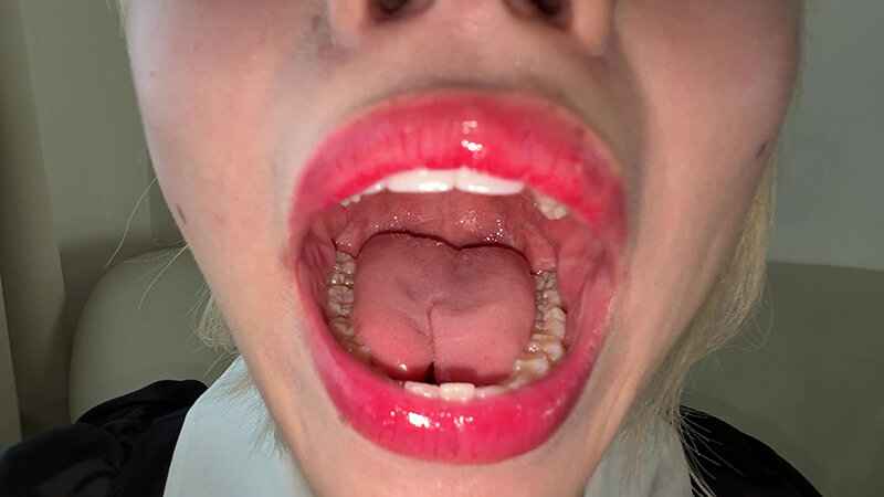 Y-296 第 3 部分 - 30 分钟