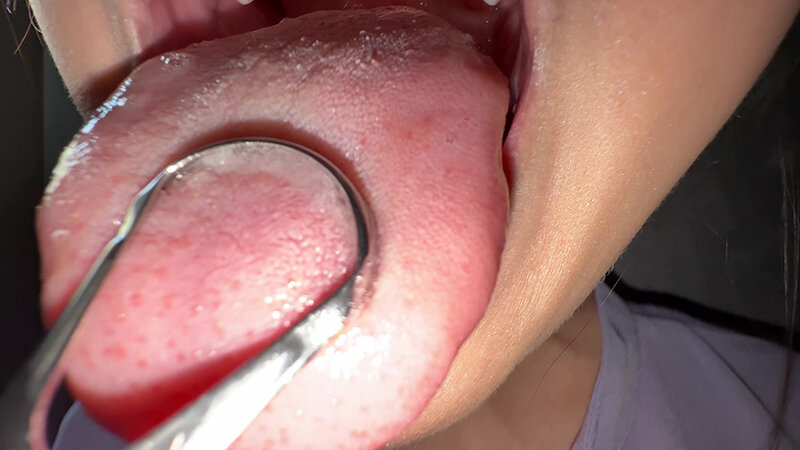 Y-303 Bagian 13 - 30 minit