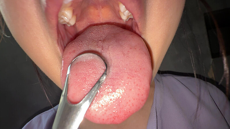 Y-303 Bagian 14 - 30 minit