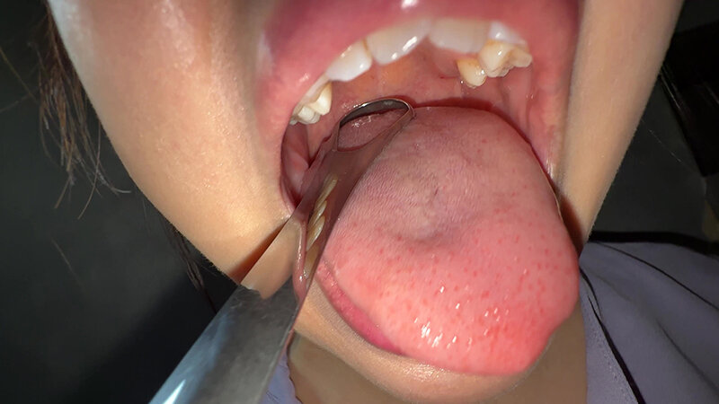 Y-303 Bagian 15 - 30 minit