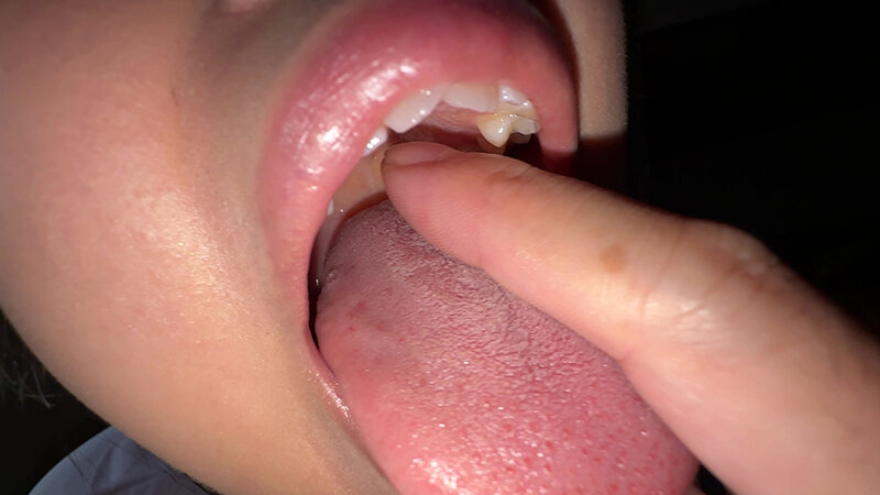 Y-304 第 12 部分 - 30 分钟